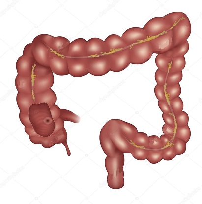 Intestino-Grosso